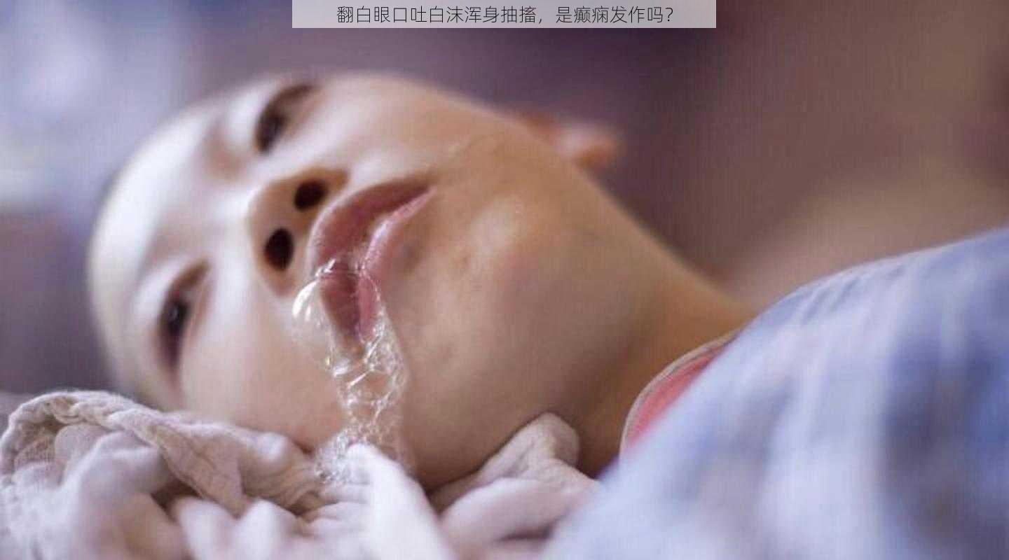 翻白眼口吐白沫浑身抽搐，是癫痫发作吗？